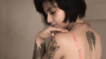 Benefits of Pico Laser Treatments